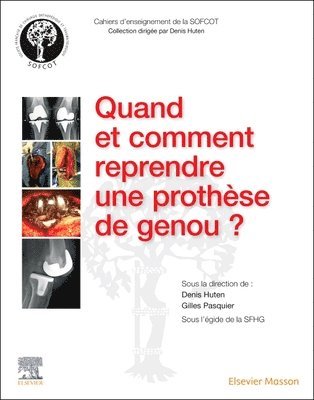 Denis Huten, Gilles-Jean-Marie Pasquier - Quand et comment reprendre une proth�se de genou ?, Häftad