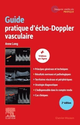 Anne Long - Guide pratique d'�cho-Doppler vasculaire, Häftad