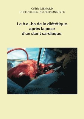Cédric Menard - b.a.-ba de la diététique après la pose d'un stent cardiaque., Häftad. Tillgänglighet: Lägg i varukorg