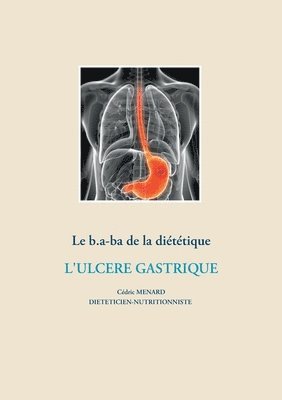 Cédric Menard - b.a-ba de la diététique pour l'ulcère gastrique, Häftad