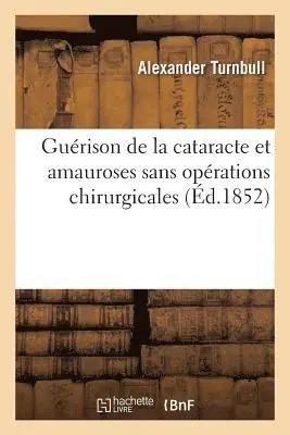 Alexander Turnbull - Guérison de la Cataracte Et Amauroses Sans Opérations Chirurgicales, Häftad. Tillgänglighet: Lägg i varukorg