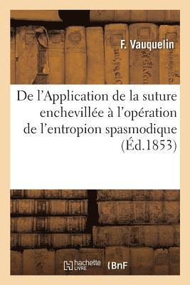 Vauquelin-F - de l'Application de la Suture Enchevillée À l'Opération de l'Entropion Spasmodique, Häftad