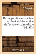 de l'Application de la Suture Enchevill�e � l'Op�ration de l'Entropion Spasmodique
