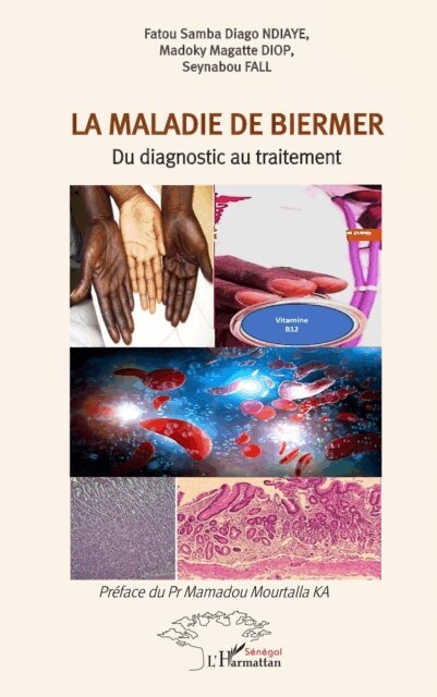 Fall, Diop, Ndiaye - La maladie de Biermer, E-bok