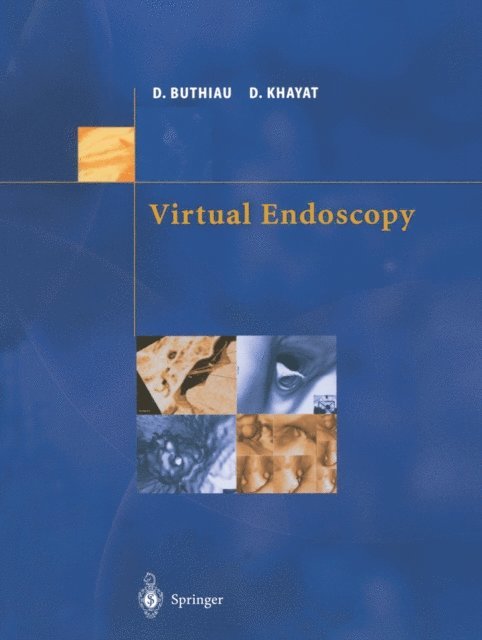 David Khayat, Didier Buthiau - Virtual Endoscopy, E-bok