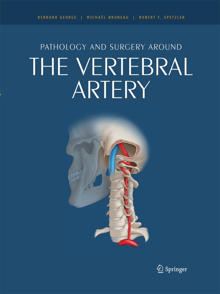 Bernard George, Michaël Bruneau - Pathology and surgery around the vertebral artery, Häftad. Tillgänglighet: Lägg i varukorg