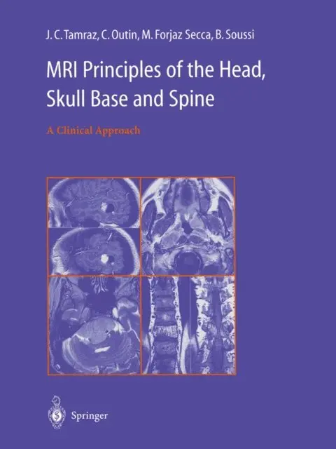 B. Soussi, M. Forjaz Secca, C. Outin, J.C. Tamraz - MRI Principles of the Head, Skull Base and Spine, E-bok. Tillgänglighet: Lägg i varukorg