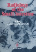 Radiology of the small intestine