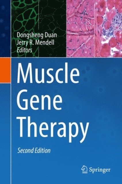 Jerry R. Mendell, Dongsheng Duan - Muscle Gene Therapy, E-bok