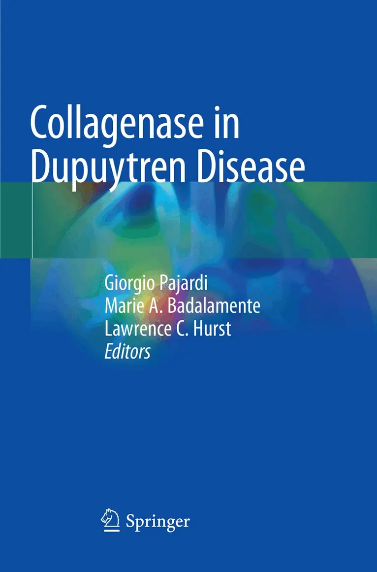 Giorgio Pajardi, Marie A. Badalamente, Lawrence C. Hurst - Collagenase in Dupuytren Disease, Häftad. Tillgänglighet: Lägg i varukorg