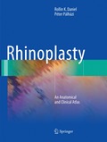 Rhinoplasty