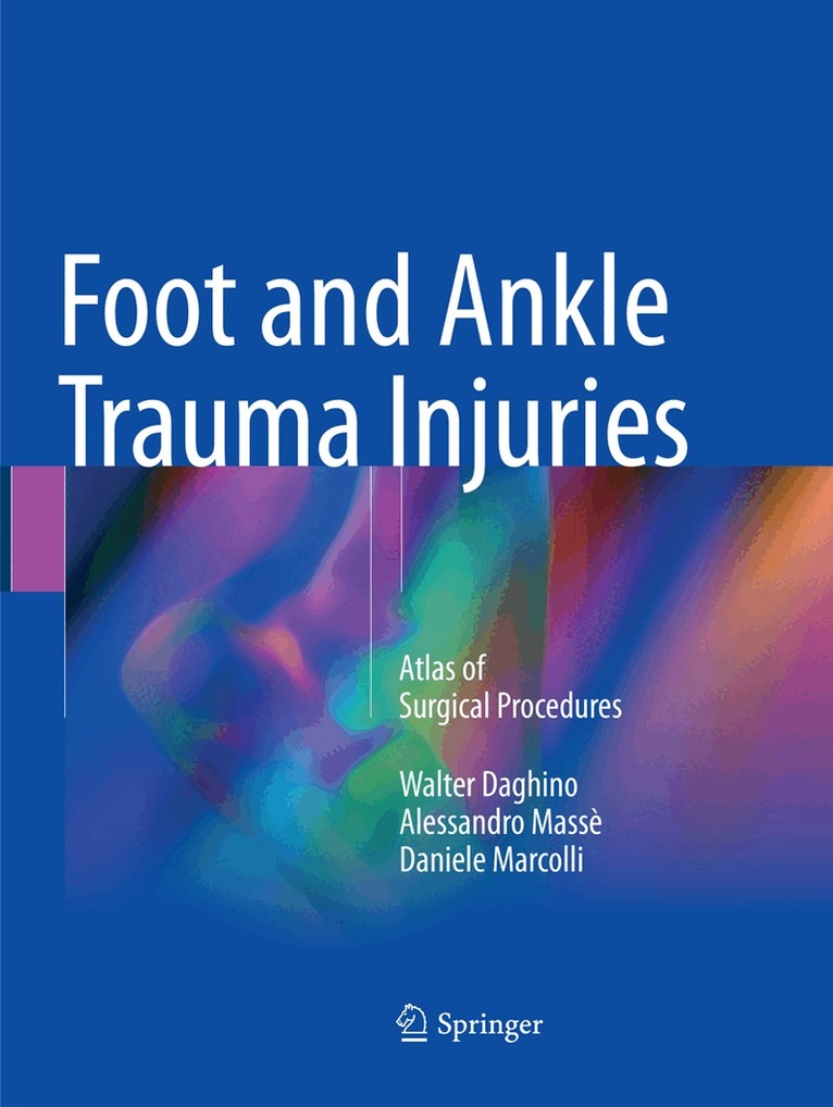 Walter Daghino, Alessandro Massè, Daniele Marcolli - Foot and Ankle Trauma Injuries, Häftad. Tillgänglighet: Lägg i varukorg
