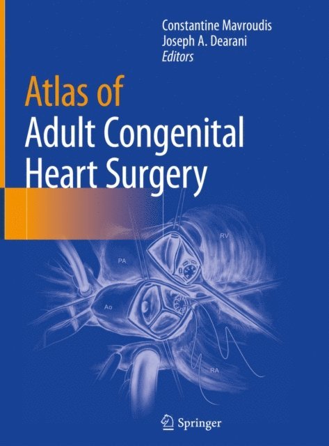 Joseph A. Dearani, Constantine Mavroudis - Atlas of Adult Congenital Heart Surgery, E-bok