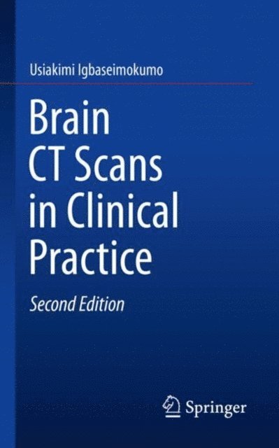 Usiakimi Igbaseimokumo - Brain CT Scans in Clinical Practice, E-bok