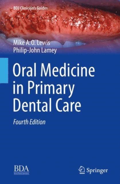 Philip-John Lamey, Michael A. O. Lewis - Oral Medicine in Primary Dental Care, E-bok