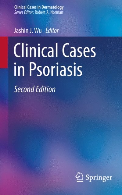 Jashin J. Wu - Clinical Cases in Psoriasis, E-bok