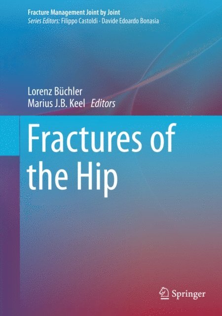 Marius J.B. Keel, Lorenz Buchler - Fractures of the Hip, E-bok. Tillgänglighet: Lägg i varukorg
