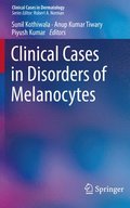 Clinical Cases in Disorders of Melanocytes