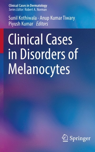 Piyush Kumar, Anup Kumar Tiwary, Sunil Kothiwala - Clinical Cases in Disorders of Melanocytes, E-bok