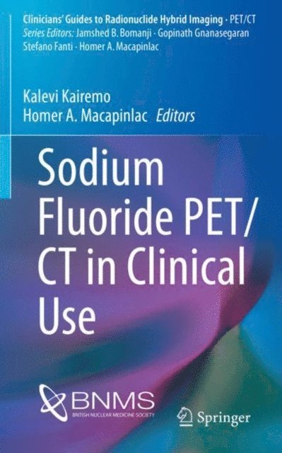 Homer A. Macapinlac, Kalevi Kairemo - Sodium Fluoride PET/CT in Clinical Use, E-bok