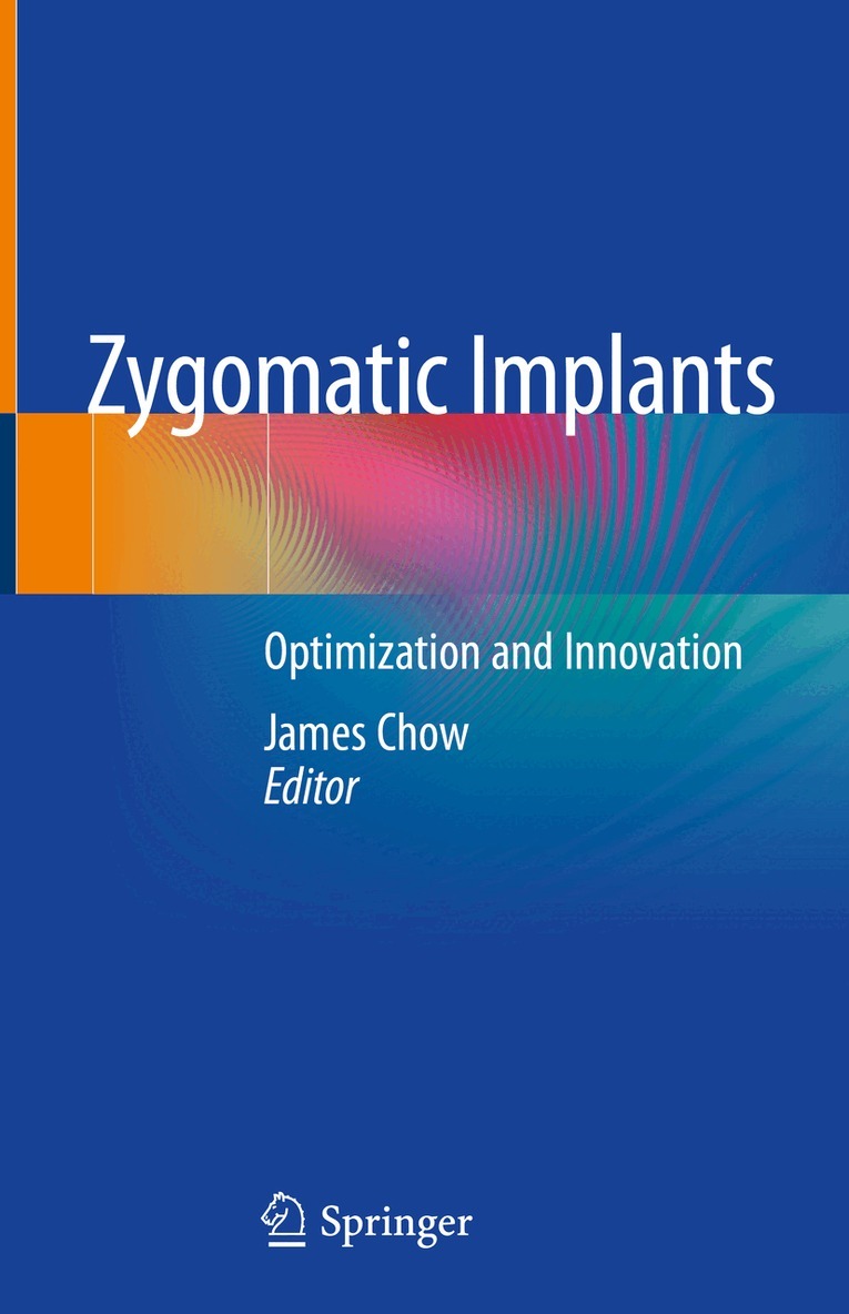 Zygomatic Implants