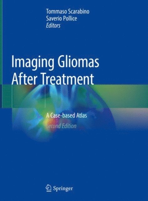 Saverio Pollice, Tommaso Scarabino - Imaging Gliomas After Treatment, E-bok