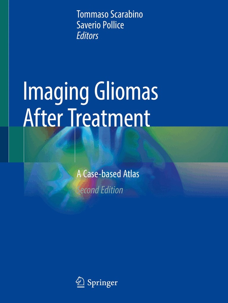 Tommaso Scarabino, Saverio Pollice - Imaging Gliomas After Treatment, Häftad