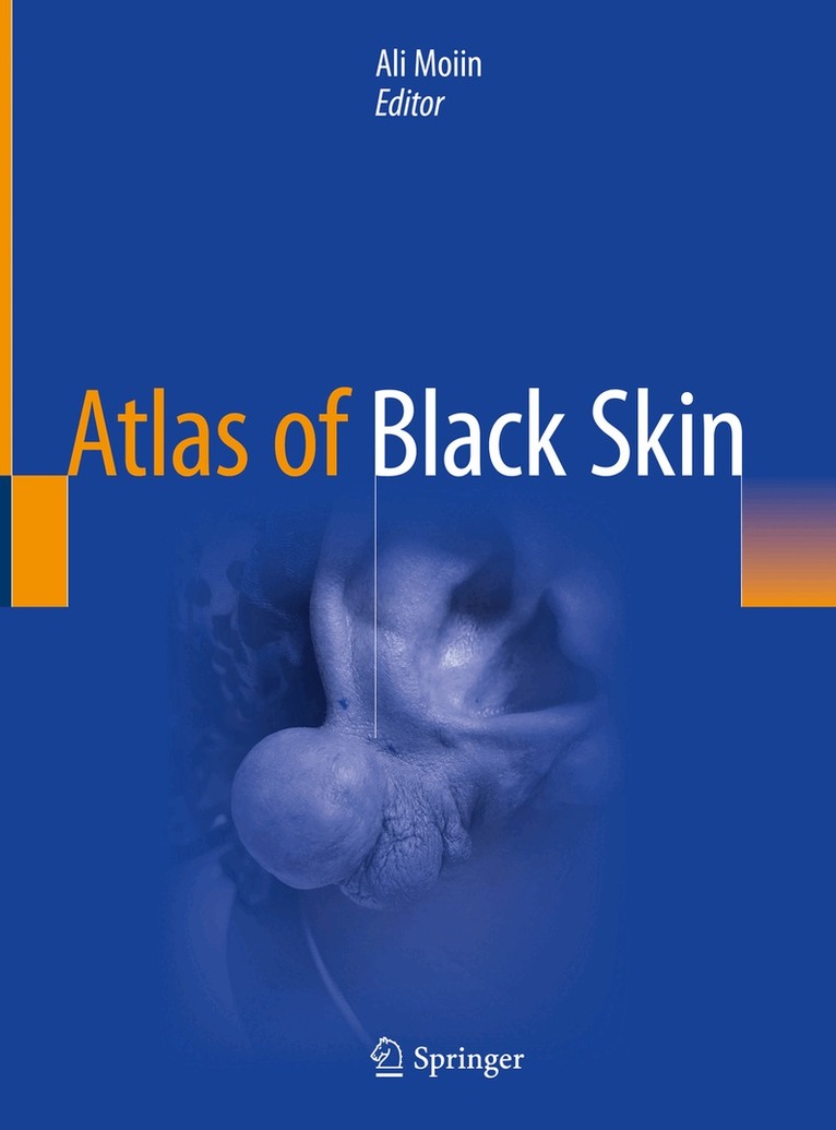 Ali Moiin - Atlas of Black Skin, Inbunden