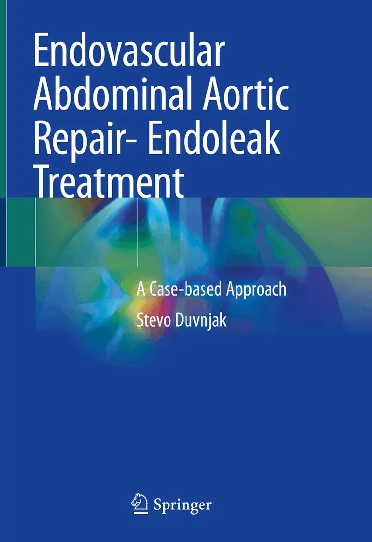 Stevo Duvnjak - Endovascular Abdominal Aortic Repair- Endoleak Treatment, Inbunden. Tillgänglighet: Lägg i varukorg