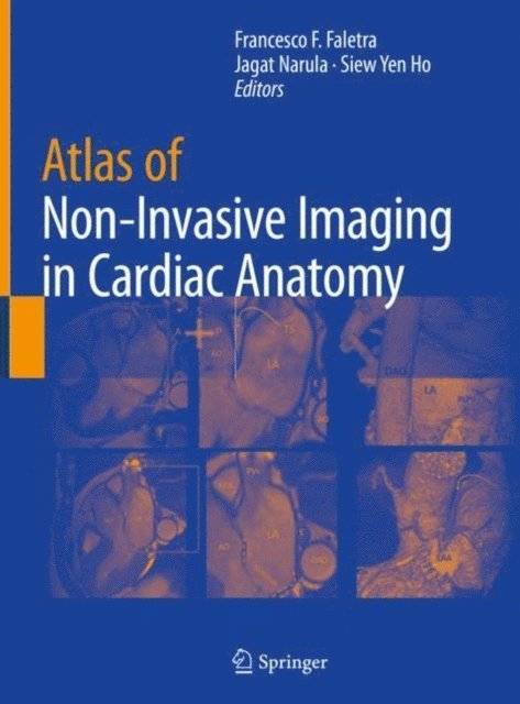 Siew Yen Ho, Jagat Narula, Francesco F. Faletra - Atlas of Non-Invasive Imaging in Cardiac Anatomy, E-bok