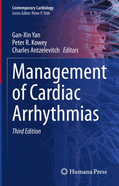 Charles Antzelevitch, Peter R. Kowey, Gan-Xin Yan - Management of Cardiac Arrhythmias, E-bok