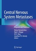 Central Nervous System Metastases