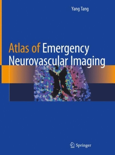 Yang Tang - Atlas of Emergency Neurovascular Imaging, E-bok