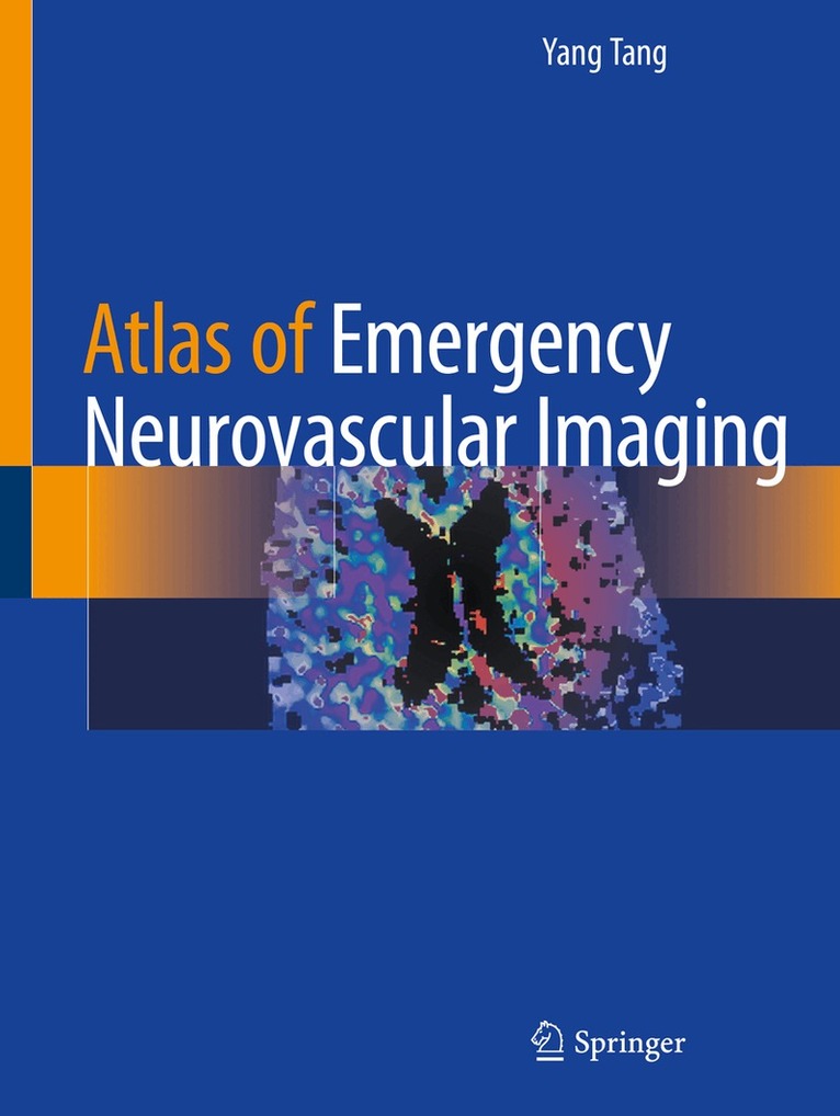 Yang Tang - Atlas of Emergency Neurovascular Imaging, Häftad