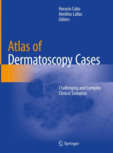 Aimilios Lallas, Horacio Cabo - Atlas of Dermatoscopy Cases, E-bok