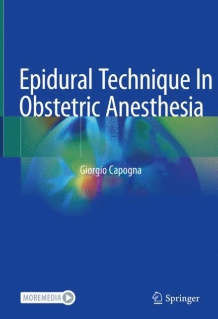 Giorgio Capogna - Epidural Technique In Obstetric Anesthesia, E-bok