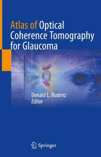 Donald L. Budenz - Atlas of Optical Coherence Tomography for Glaucoma, E-bok