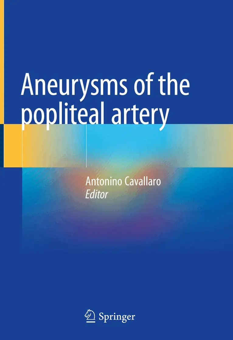 Antonino Cavallaro - Aneurysms of the Popliteal Artery, Inbunden. Tillgänglighet: Lägg i varukorg