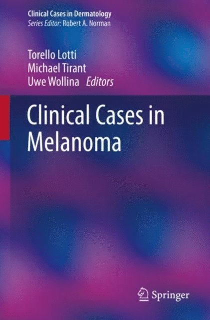 Uwe Wollina, Michael Tirant, Torello Lotti - Clinical Cases in Melanoma, E-bok