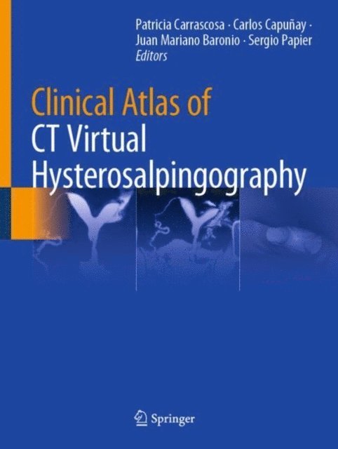 Sergio Papier, Juan Mariano Baronio, Carlos Capunay, Patricia Carrascosa - Clinical Atlas of CT Virtual Hysterosalpingography, E-bok