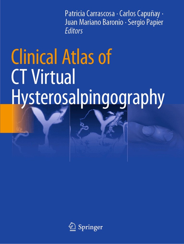 Patricia Carrascosa, Carlos Capuñay, Juan Mariano Baronio, Sergio Papier - Clinical Atlas of CT Virtual Hysterosalpingography, Häftad