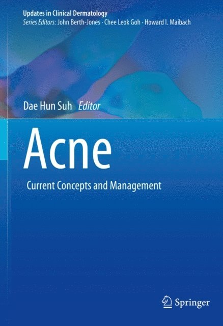 Dae Hun Suh - Acne, E-bok
