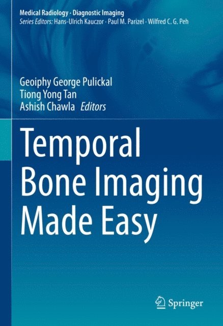 Ashish Chawla, Tiong Yong Tan, Geoiphy George Pulickal - Temporal Bone Imaging Made Easy, E-bok