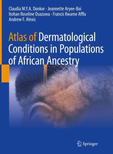 Andrew F. Alexis, Francis Kwame Afflu, Itohan Roseline Osazuwa, Jeannette Aryee-Boi, Claudia M.Y.A. Donkor - Atlas of Dermatological Conditions in Populations of African Ancestry, E-bok