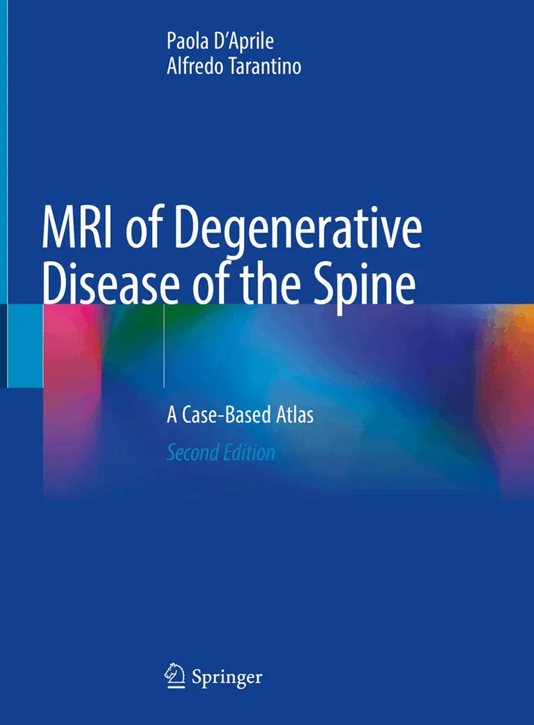 Paola D'Aprile, Alfredo Tarantino - MRI of Degenerative Disease of the Spine, Inbunden. Tillgänglighet: Lägg i varukorg