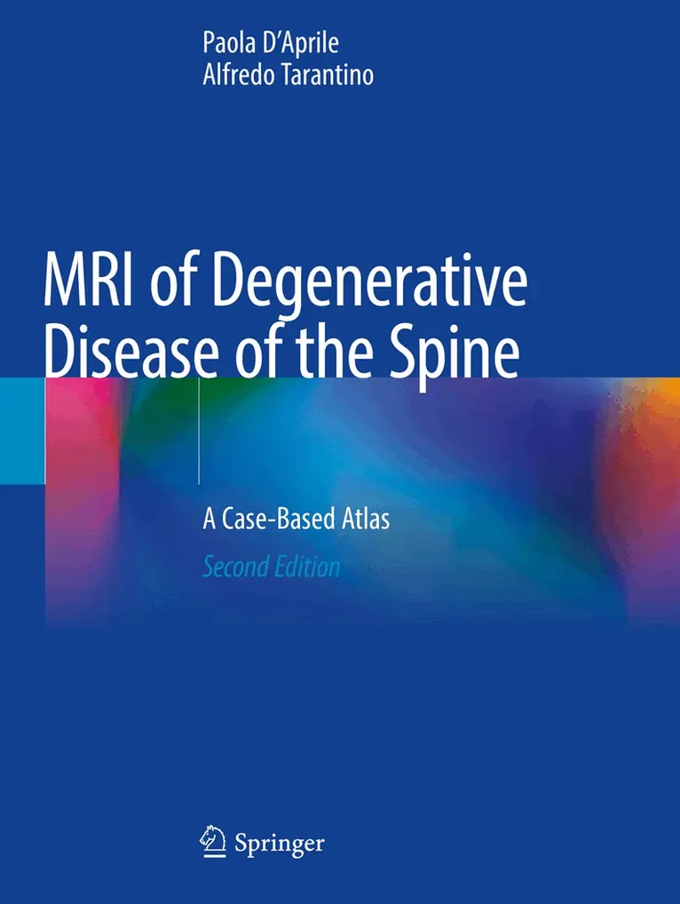 Paola D'Aprile, Alfredo Tarantino - MRI of Degenerative Disease of the Spine, Häftad. Tillgänglighet: Lägg i varukorg