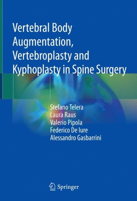 Alessandro Gasbarrini, Federico De Iure, Valerio Pipola, Laura Raus, Stefano Telera - Vertebral Body Augmentation, Vertebroplasty and Kyphoplasty in Spine Surgery, E-bok