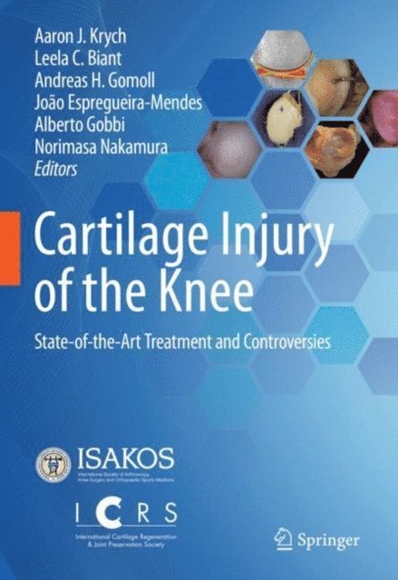 Norimasa Nakamura, Alberto Gobbi, Joao Espregueira-Mendes, Andreas H. Gomoll, Leela C. Biant, Aaron J. Krych - Cartilage Injury of the Knee, E-bok