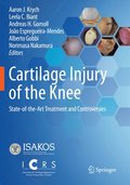 Cartilage Injury of the Knee