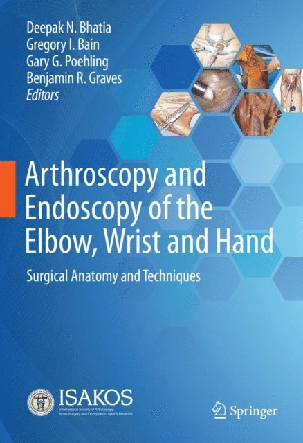 Benjamin R. Graves, Gary G. Poehling, Gregory I. Bain, Deepak N. Bhatia - Arthroscopy and Endoscopy of the Elbow, Wrist and Hand, E-bok